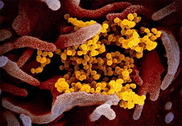 Coronavirus image